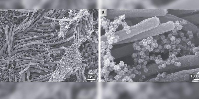 Virüsün solunum yolu tahribatı mikroskopla kaydedildi